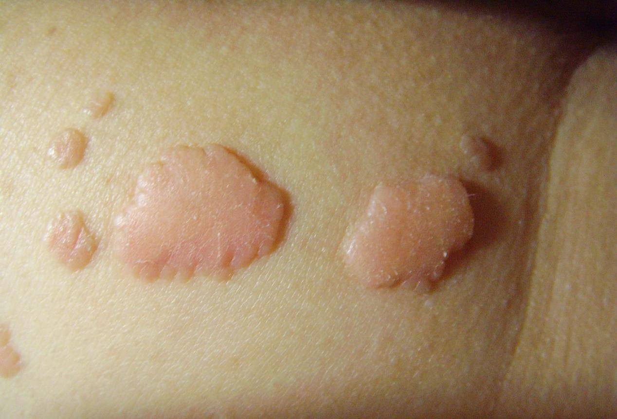 ����ʪ����õ����Ʒ���