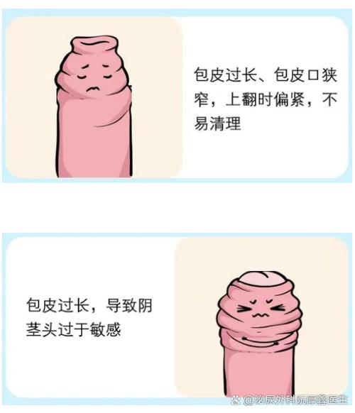 补肾药治疗阳萎早泄_阳萎吃补肾的药行吗 补肾药治疗阳萎早泄_阳萎吃补肾的药行吗