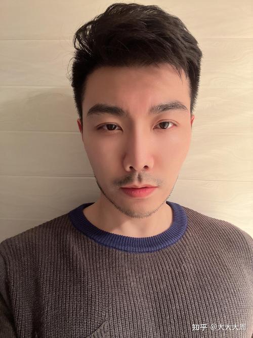 血尿病的症状 血尿病的症状