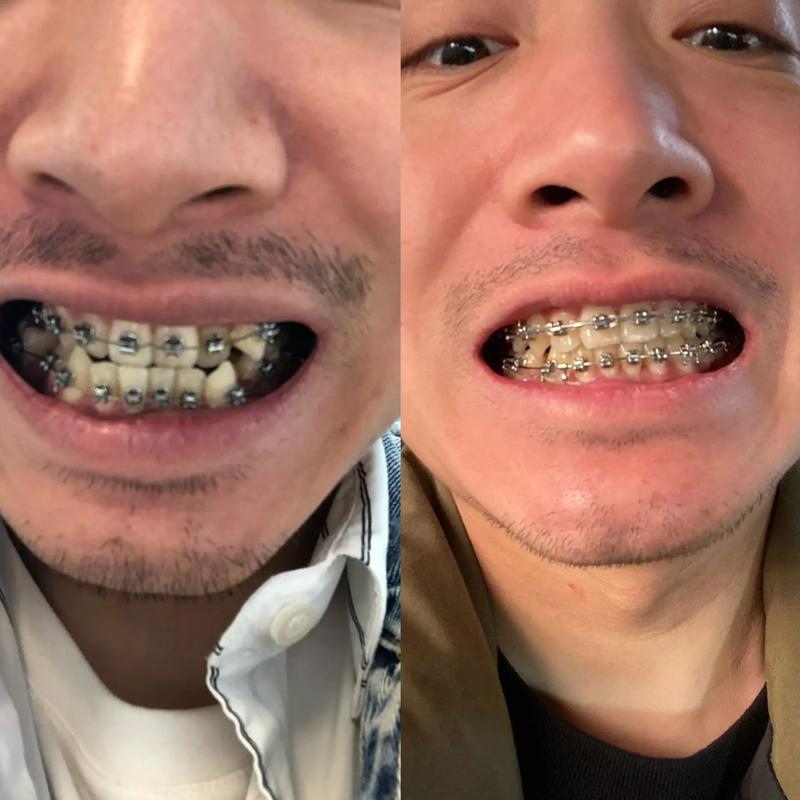 ��˳��й�ĸ�ҽԺ���ĺ�