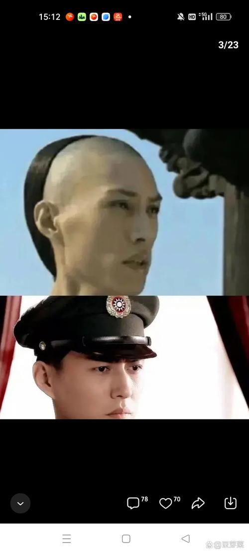 阳萎缩是什么样子什么叫阳萎缩怎么治疗 阳萎缩是什么样子什么叫阳萎缩怎么治疗