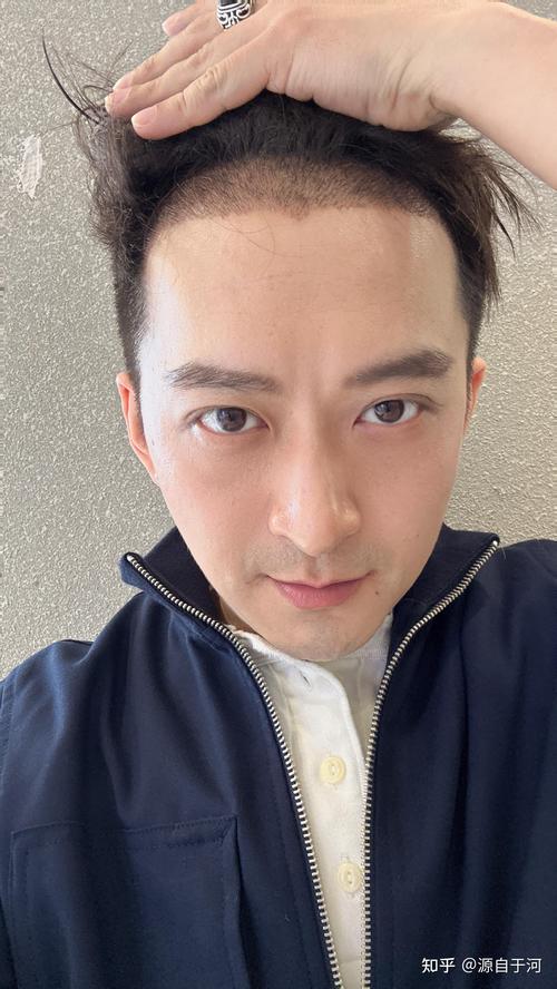 Ӳ�Ȳ�������ô�ˣ�Ӳ�Ȳ���ʱ��̳�ɶҩ��