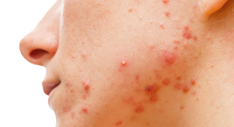 ���ֲ�Ҷ׳�����������